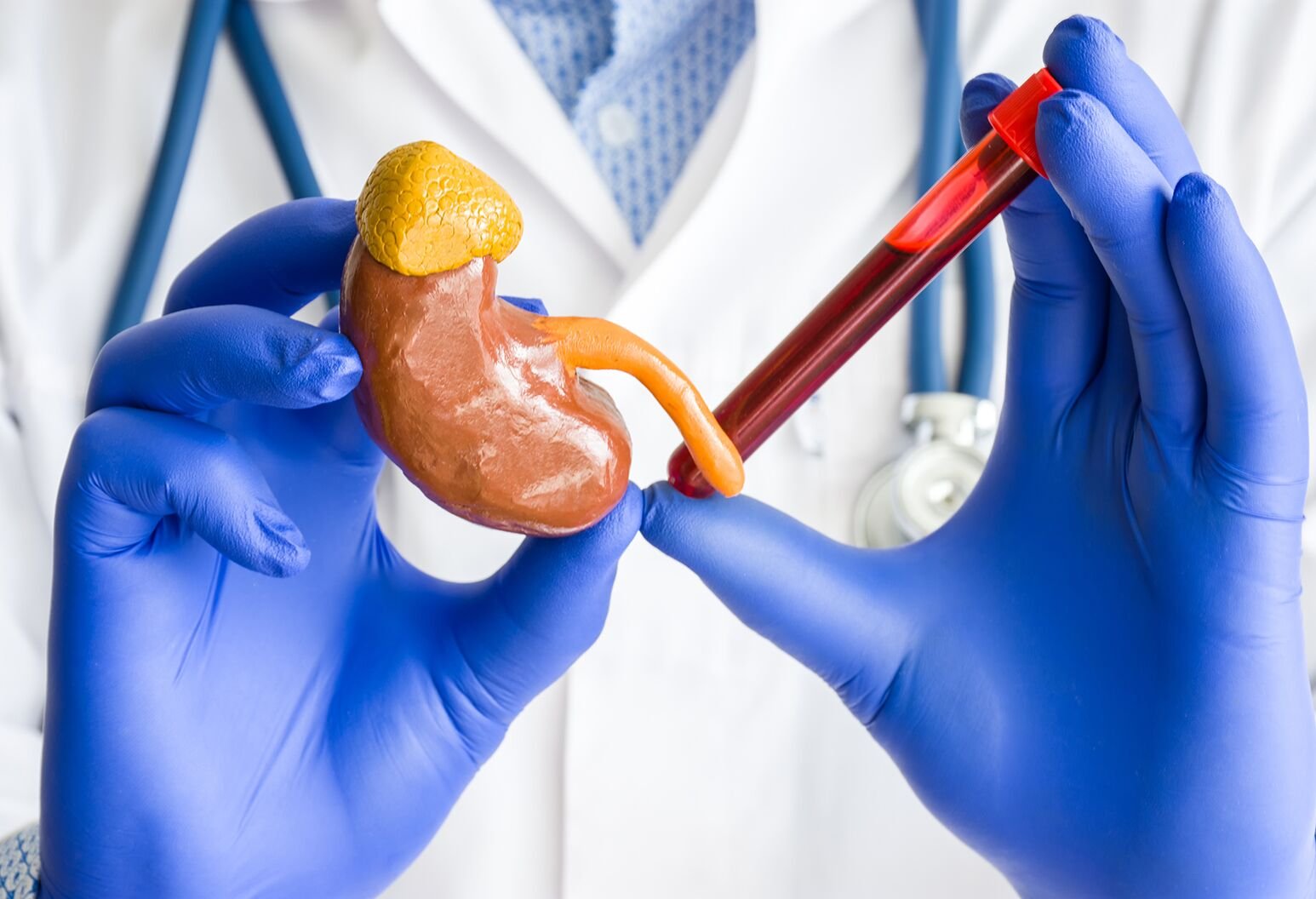 Blood test shows if organs are aging fast or slow
